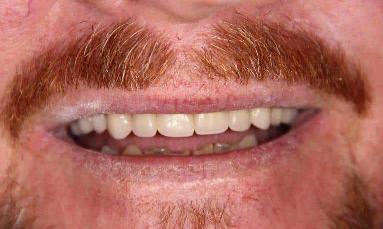 Close-up of smiling mouth displaying teeth and natural smile for dental care website