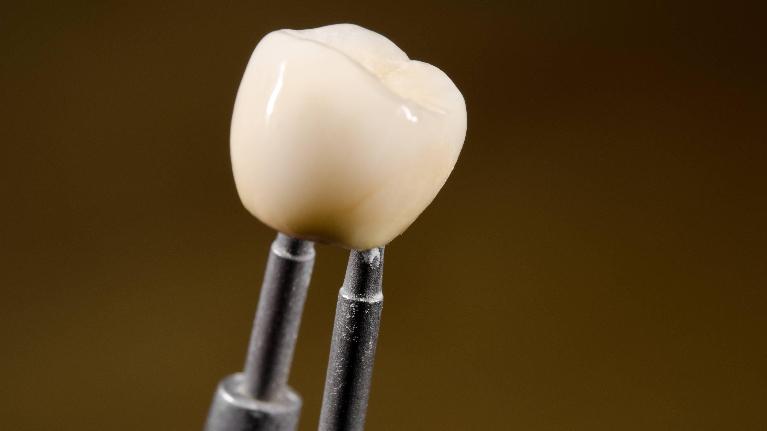 Dental crown model displayed on metal instruments against brown background