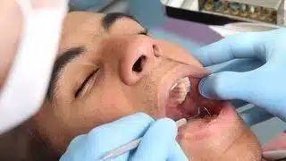 Dentist examining patient's open mouth during dental procedure with gloved hands in clinical setting.