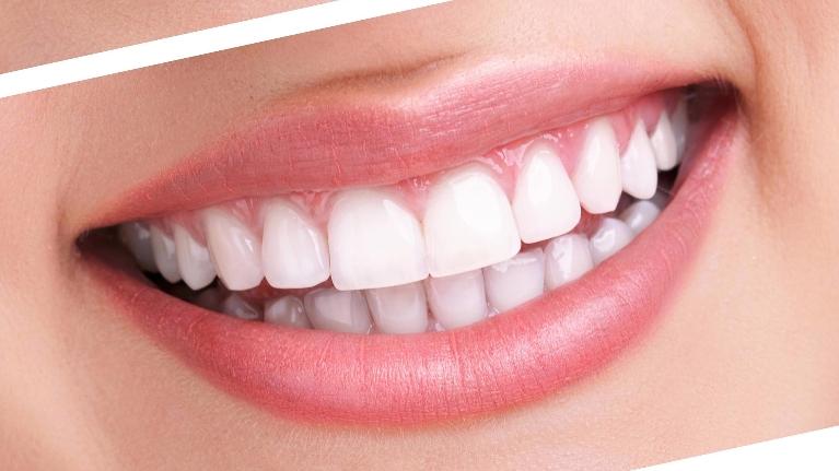 Close-up of a bright, healthy smile showing white teeth and pink lips against natural skin tone.