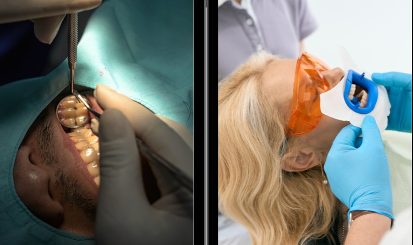 Root Canal vs. Tooth Extraction
