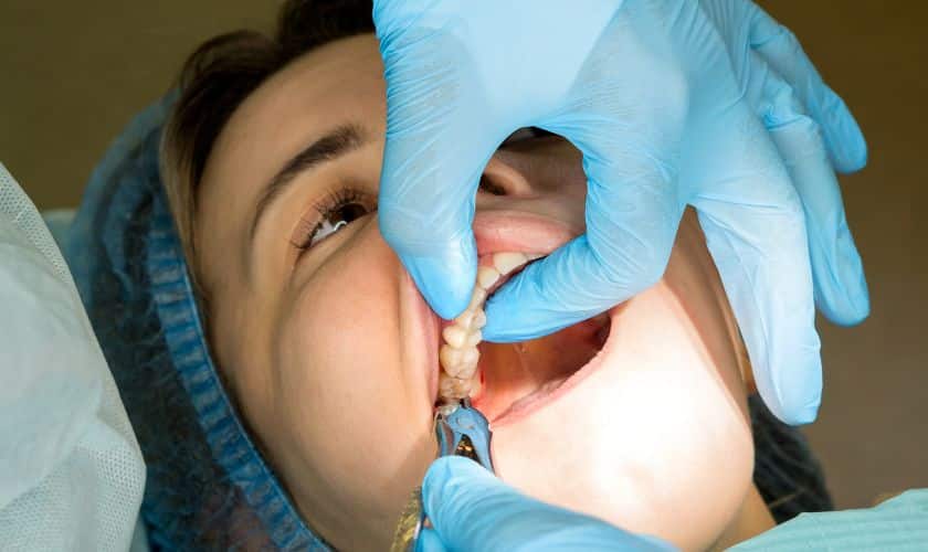Tooth Extraction And Anxiety: Managing Dental Fear During The Procedure
