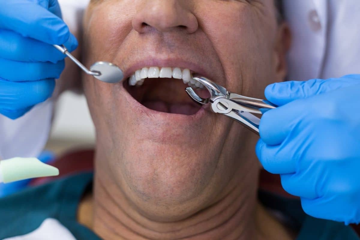 Dentist examining patient's teeth with dental tools during oral examination in clinical setting.